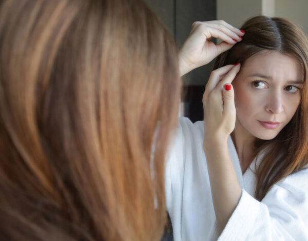 prekomerno izpadajo lasje